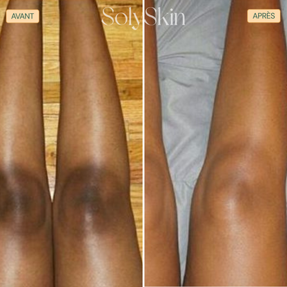 Soin Nettoyant Anti-Imperfections au Curcuma