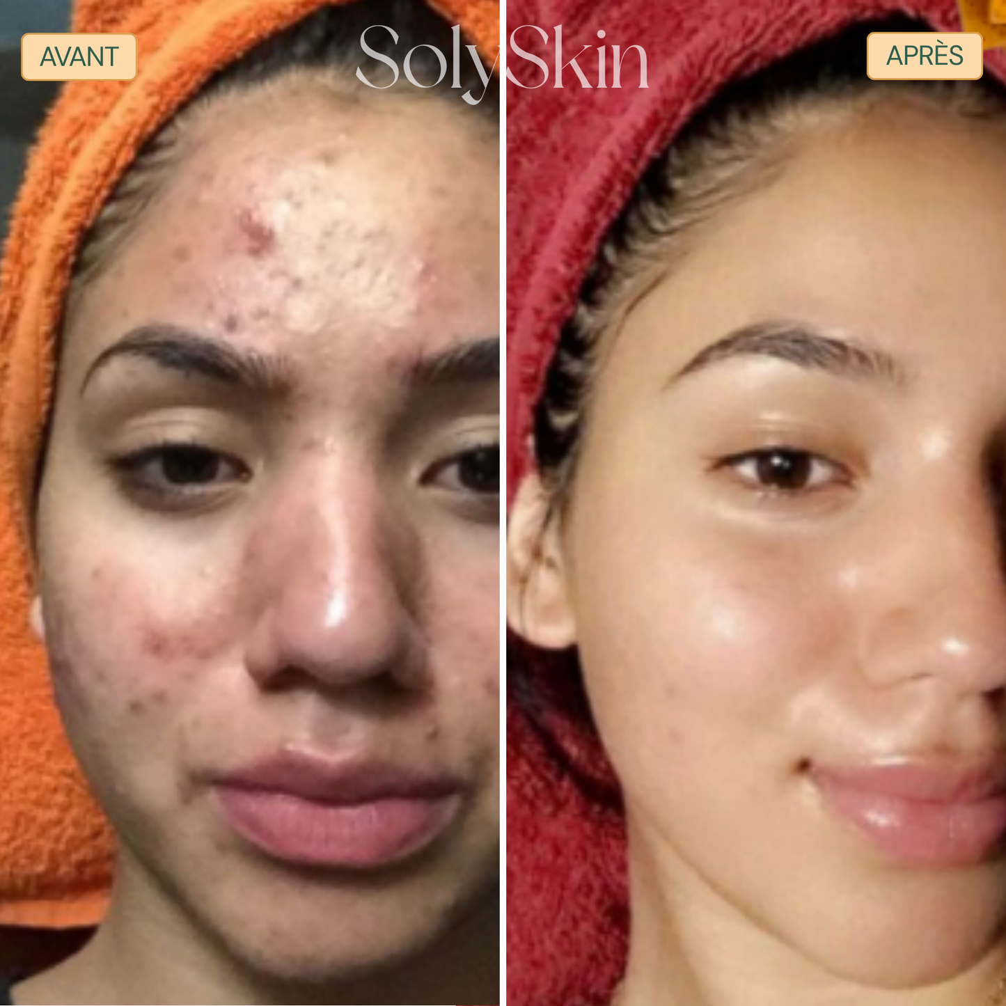 Soin Nettoyant Anti-Imperfections au Curcuma