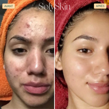 Soin Nettoyant Anti-Imperfections au Curcuma