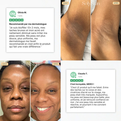 Soin Nettoyant Anti-Imperfections au Curcuma