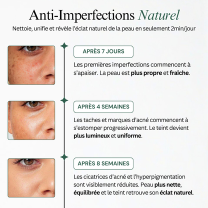 Soin Nettoyant Anti-Imperfections au Curcuma
