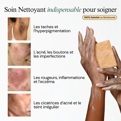Soin Nettoyant Anti-Imperfections au Curcuma